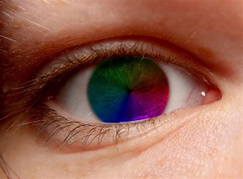 Pictures of Unusual Eye Conditions .